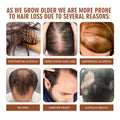 EELHOE Batana Oil Conditioner Moisturizes, Repairs, Strengthens Hair Roots, Prevents Supple, Dense Hair, And Solidifies And Fluffy Hair